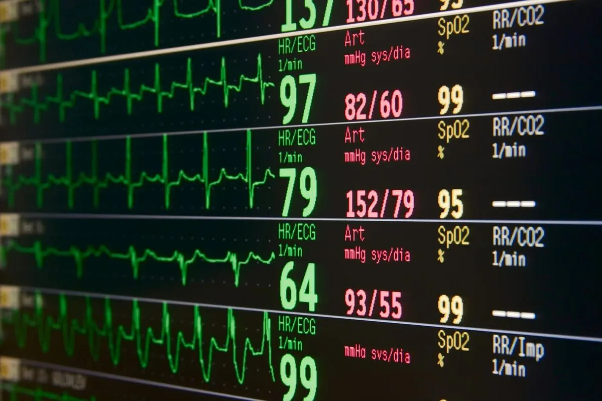 EKG Abnormal: Normal atau Bahaya? Kenali Artinya